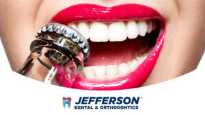 SODA VERSUS OUR TEETH
